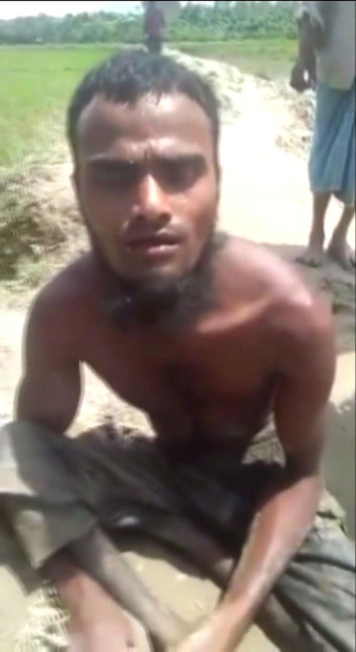 Arakanlı Engelli Abdullah, 18 Günde Bangladeş\'e Geldi
