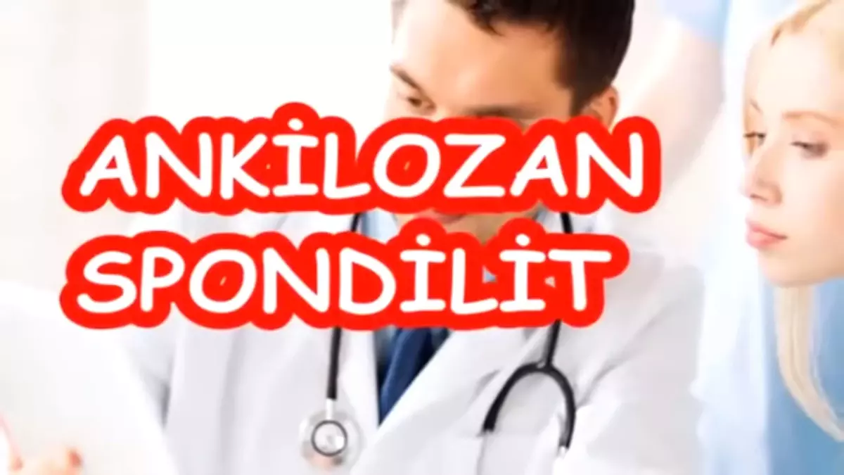 Ankilozan Spondilit