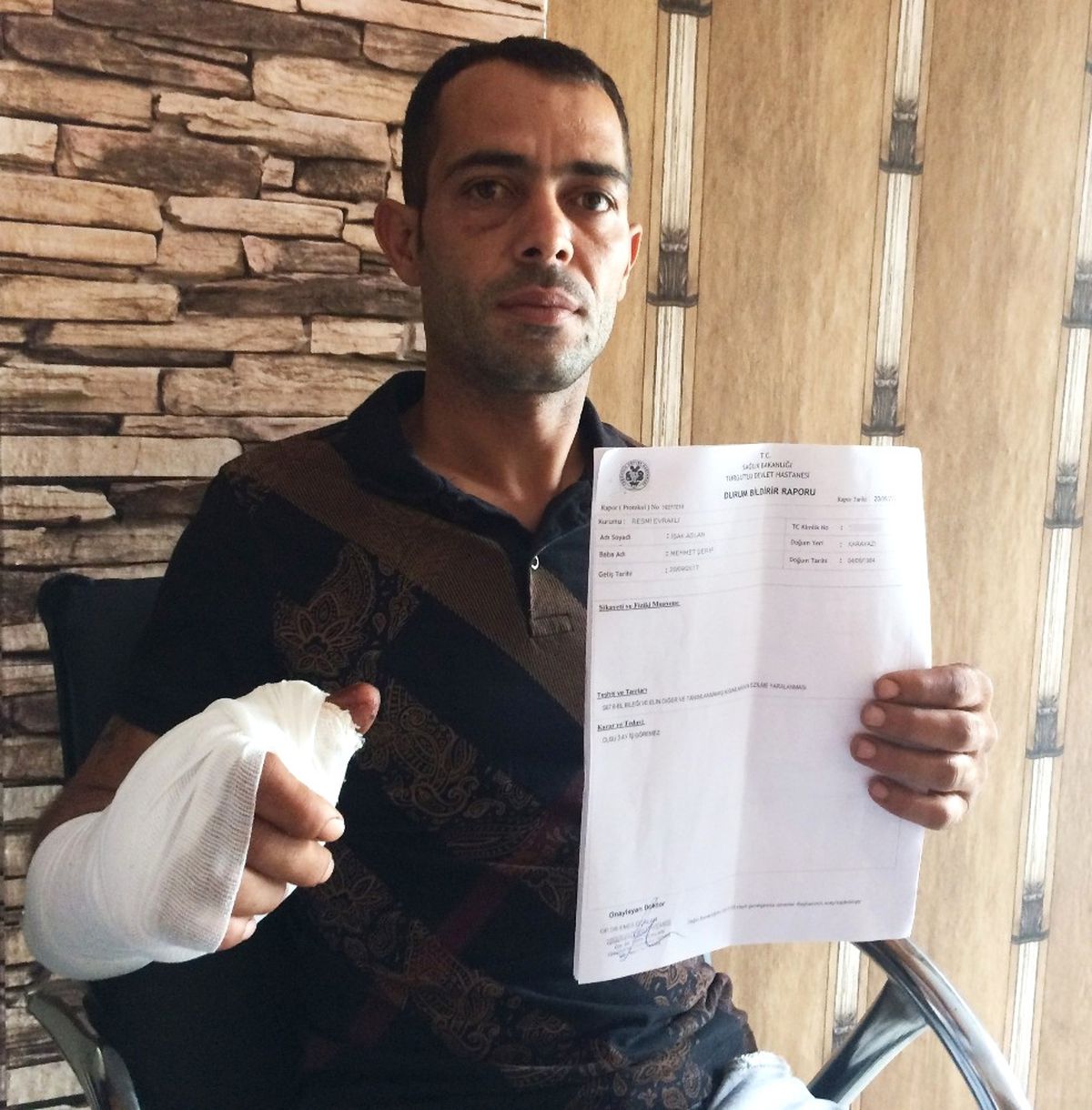 Alkol Şişesi Elinde Patladı