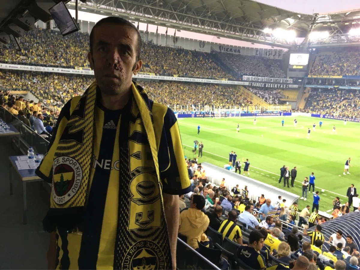 Fenerbahçe Hayali Gerçekleştikten Bir Hafta Sonra Öldü
