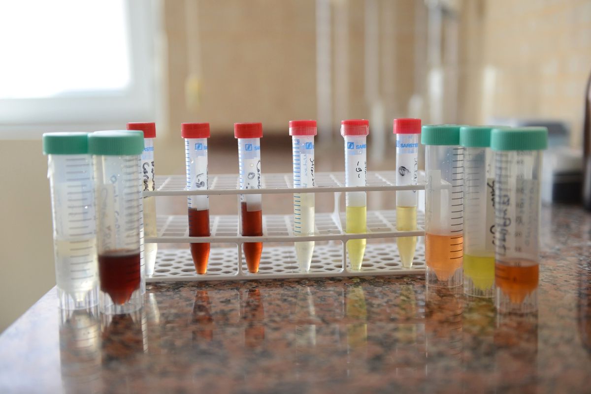 Elektronik Sigarada Gizli Tehlike: Aroma
