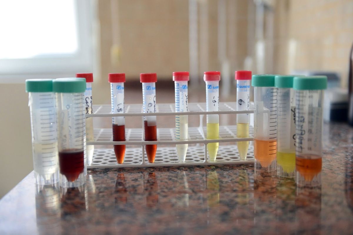 Elektronik Sigarada Gizli Tehlike: Aroma