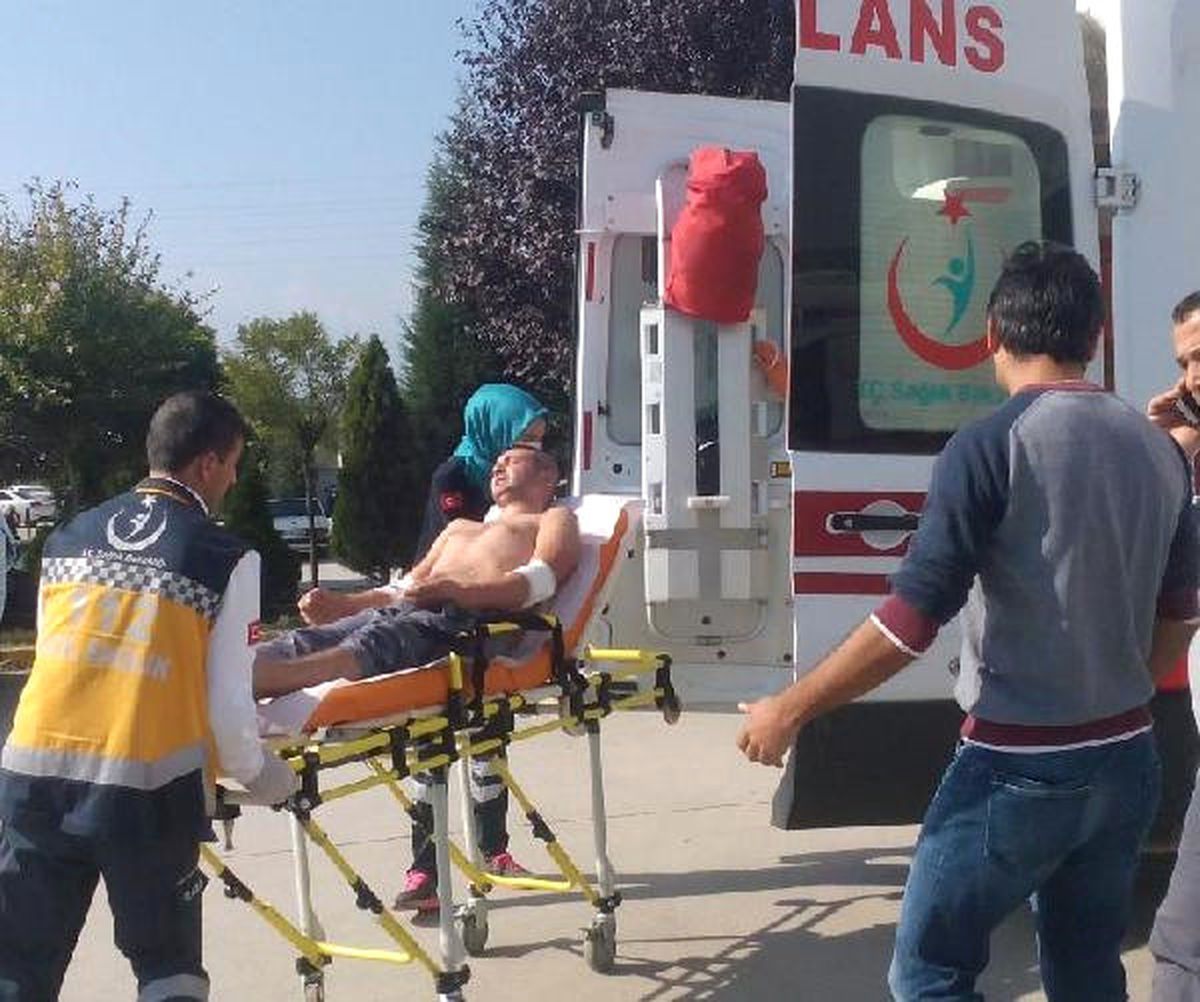 Fabrikada Üzerlerine Asit Sıçrayan 2 İşçi Yaralandı