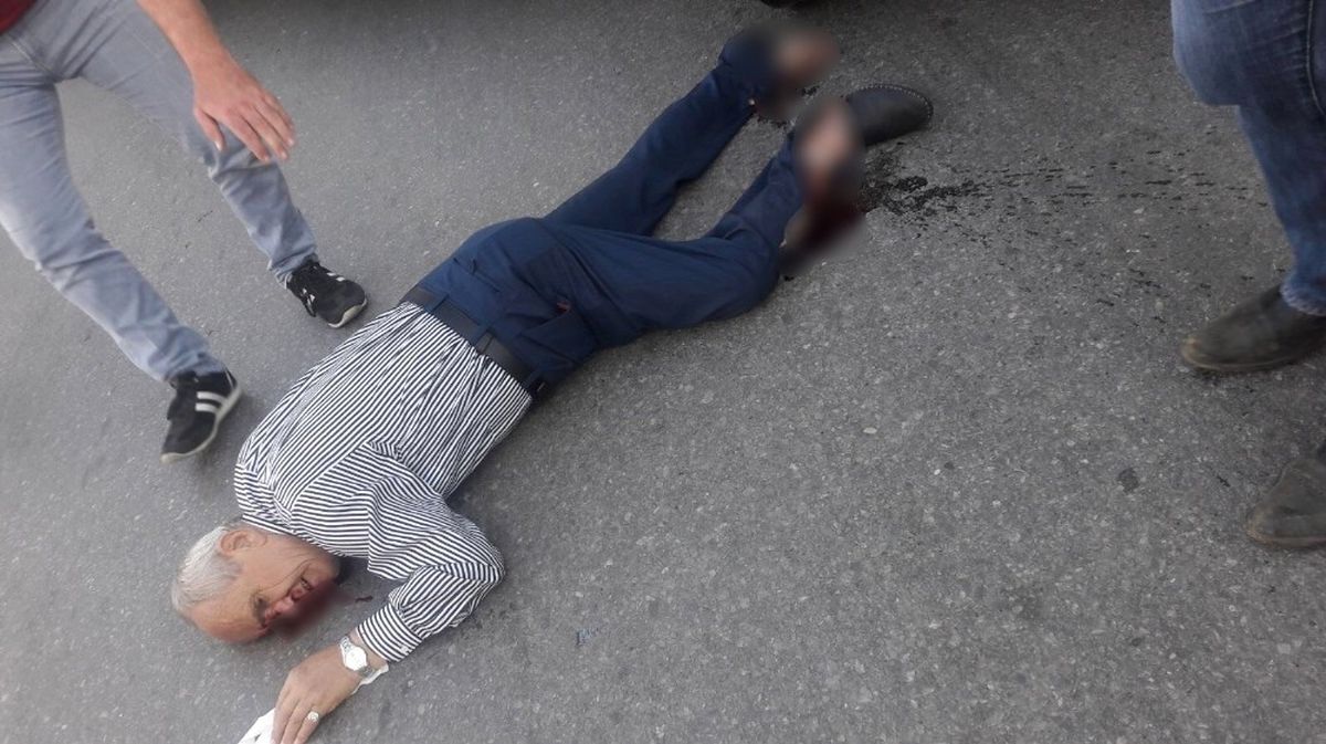 Otobüsün Altında Kalan Yaşlı Adamın Ayağı Koptu