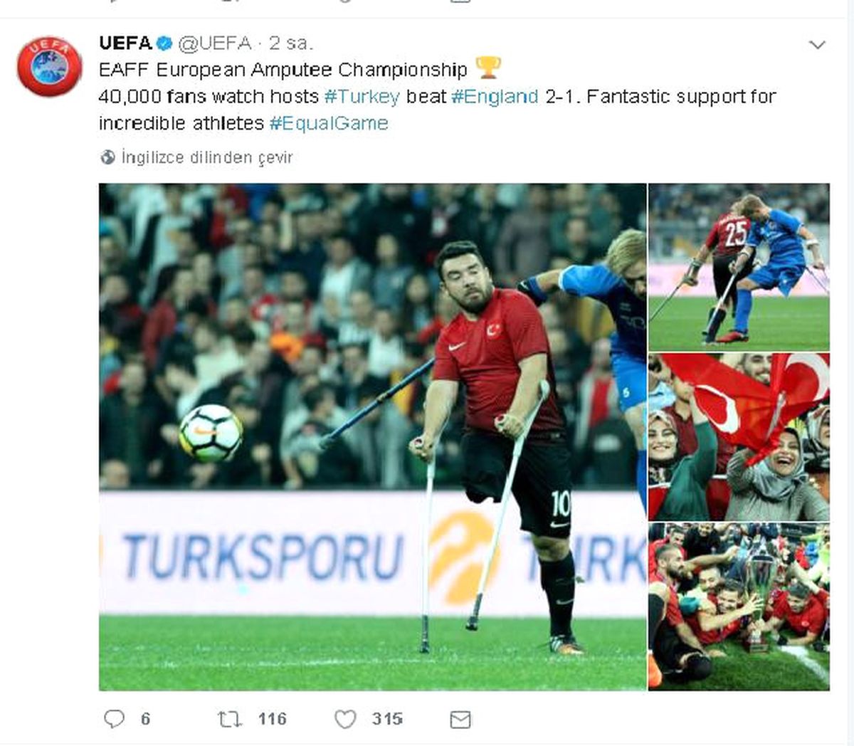 Ampute Milli Takımı Dünyanın Gündeminde