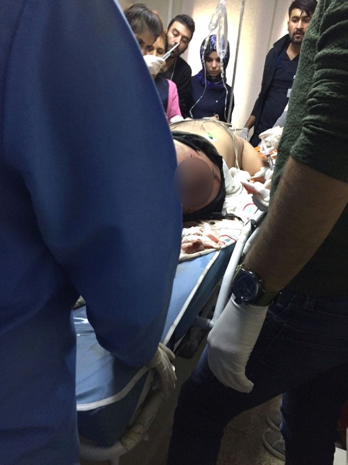 Pervari\'de Tuzaklı Eyp İş Makinesinin Geçişi Sırasında Patlatıldı: 1 Yaralı
