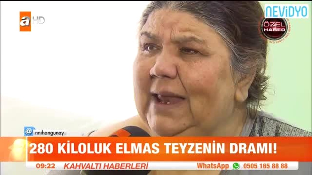 280 Kiloluk Fil Hastası Elmas Teyzenin Dramı!
