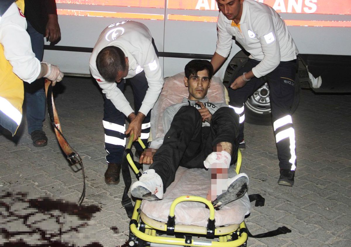 Şanlıurfa\'da Bıçaklı Kavga: 1 Yaralı