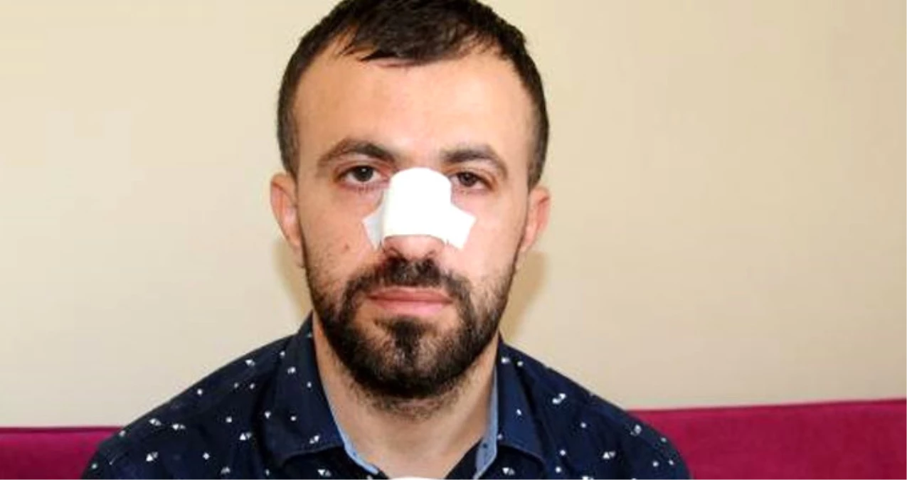 Hasta Yakını, Gürültü Yaptıkları İçin Uyaran Erkek Hemşirenin Burnunu Kırdı