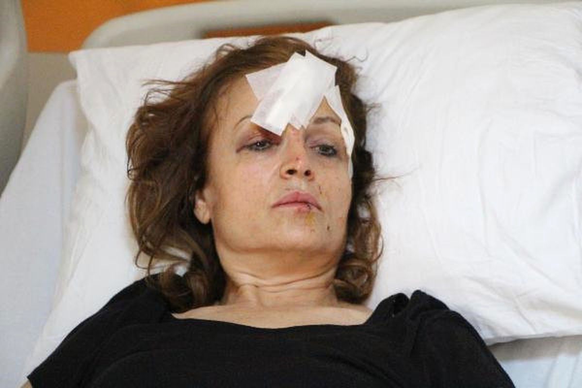 Başına Cam Tabla Düşen Doktor Ağır Yaralandı (3)