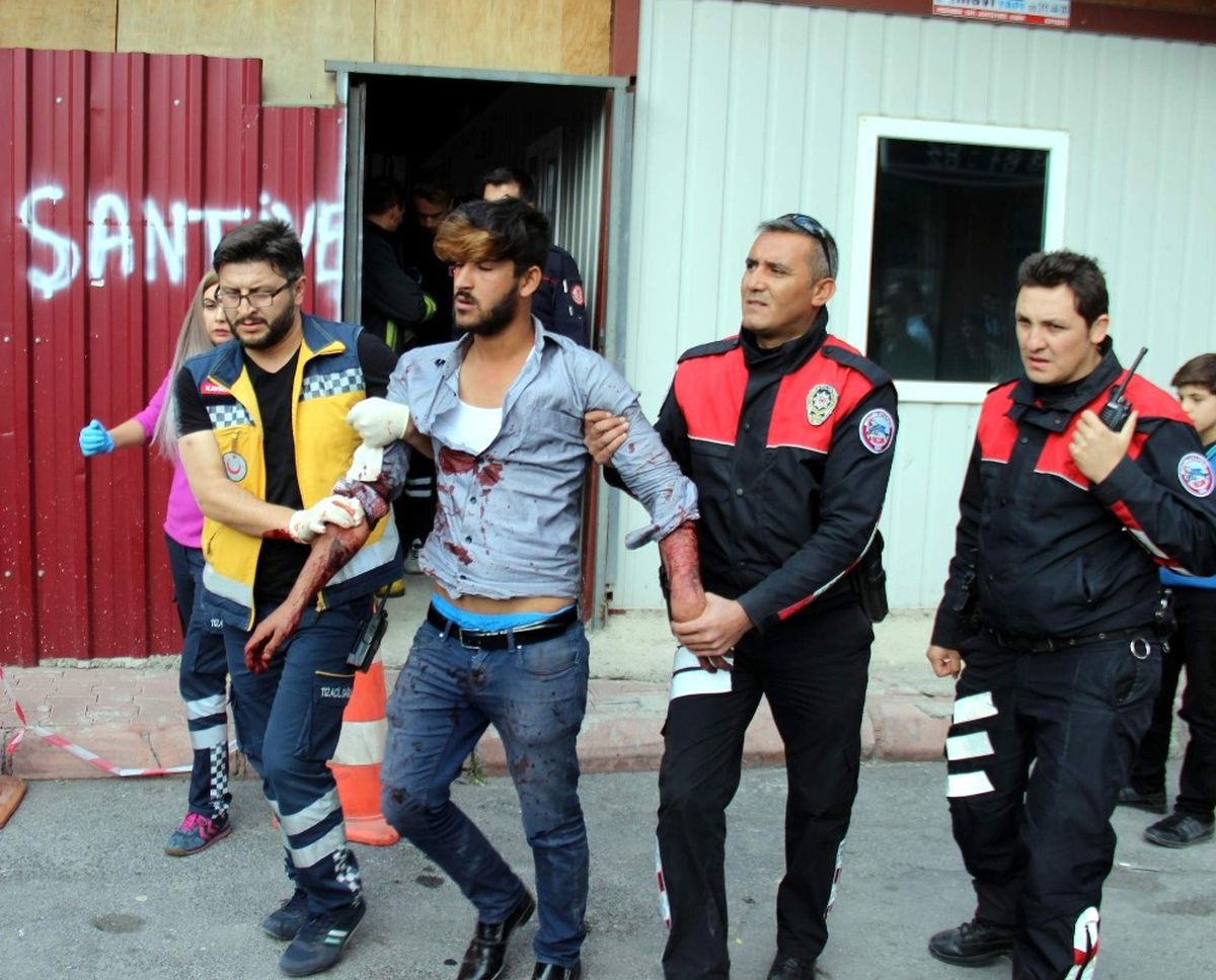 İntihar Etmek İsteyen Şahıs Bayılınca Kurtarıldı