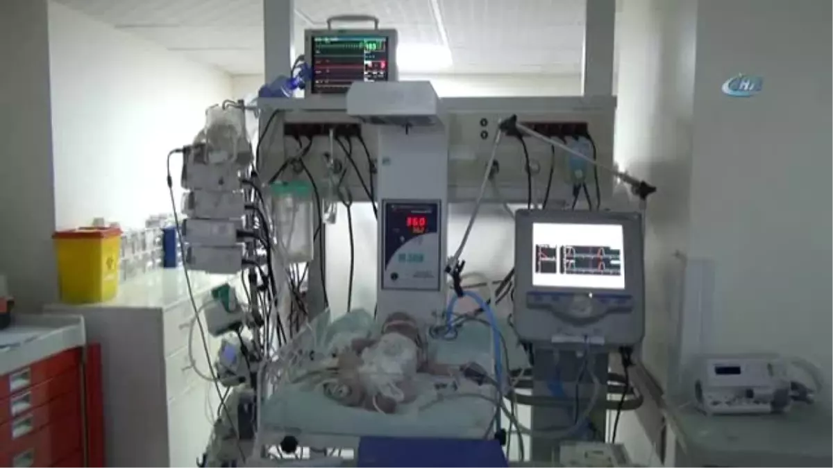 Kalbinin Yarısı Çalışmayan Suriyeli Bebek Ameliyat Oldu