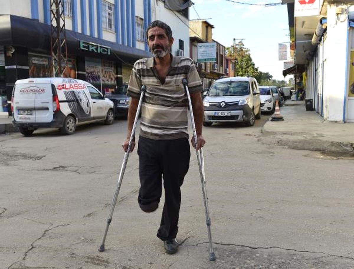 Protezi Çalınan Engelli, Yardım Bekliyor