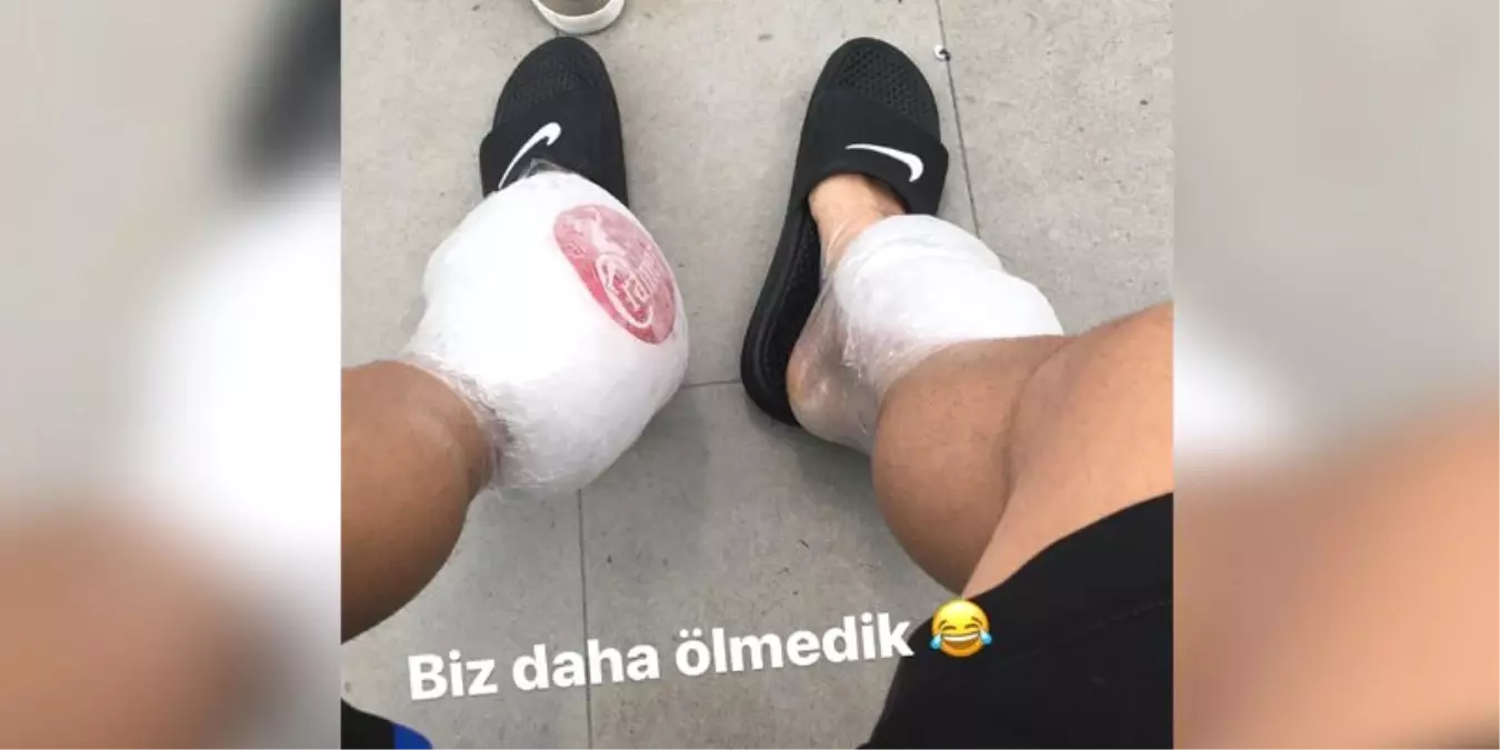 Deportivolu Emre Çolak, Instagram\'dan Ayağının Son Halini Paylaştı