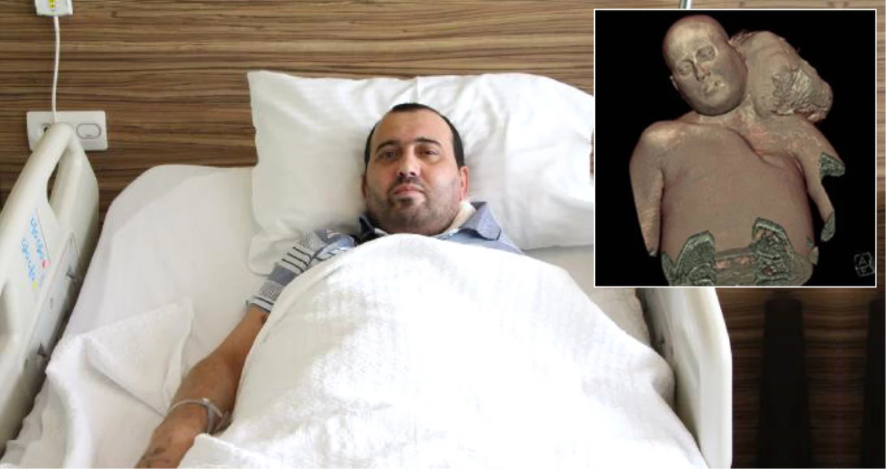 Boynundaki 8 Kiloluk Tümöründen Türkiye\'de Kurtuldu