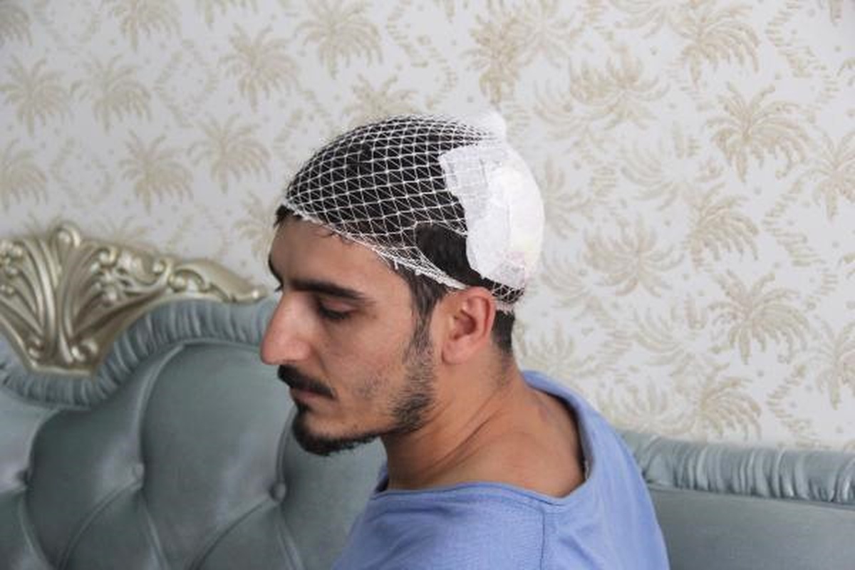 Öğretmen, Kantin İşletmecisi ve Yakınları Tarafından Dövüldü