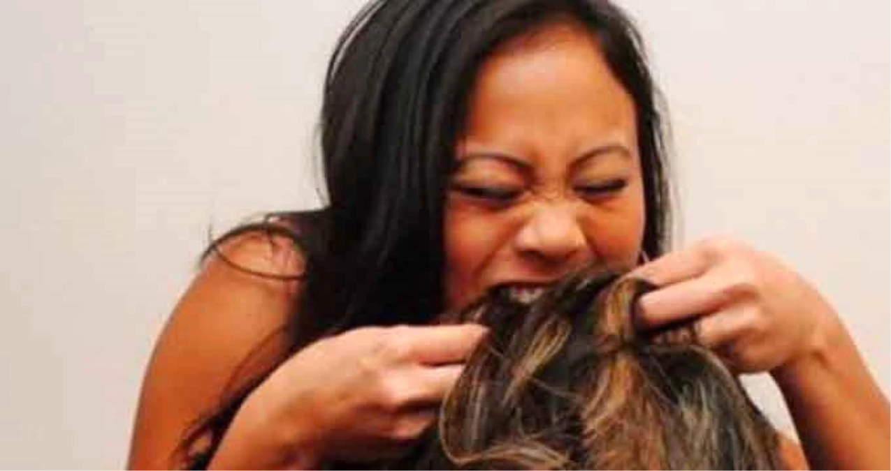 Rapunzel Sendromu Vardı, Midesinden 3 Kiloluk Saç Yumağı Çıktı