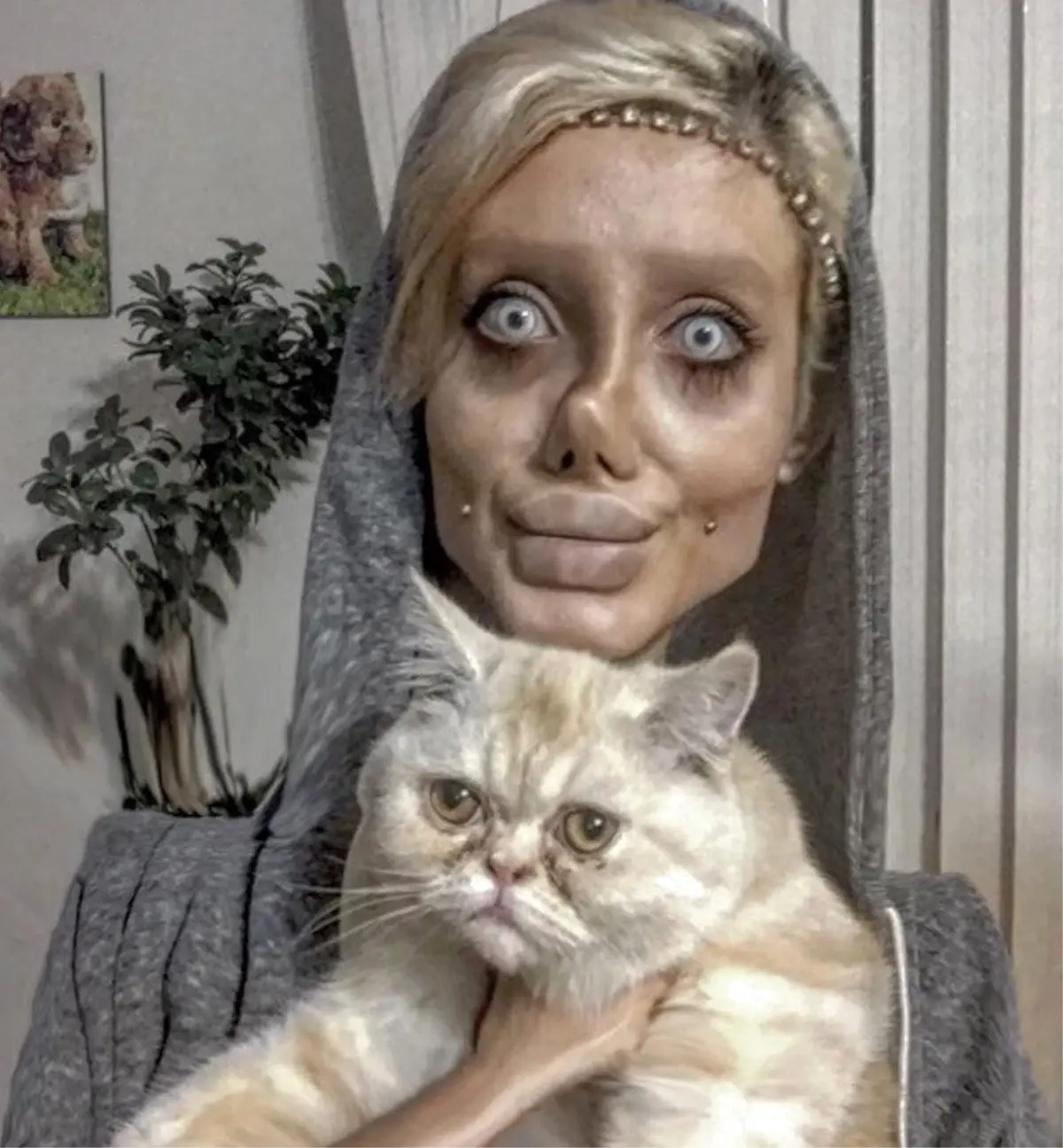 Angelina Jolie\'ye Benzemek İçin Bıçak Altına Yatan İranlı Genç Kız, Tanınmaz Halde