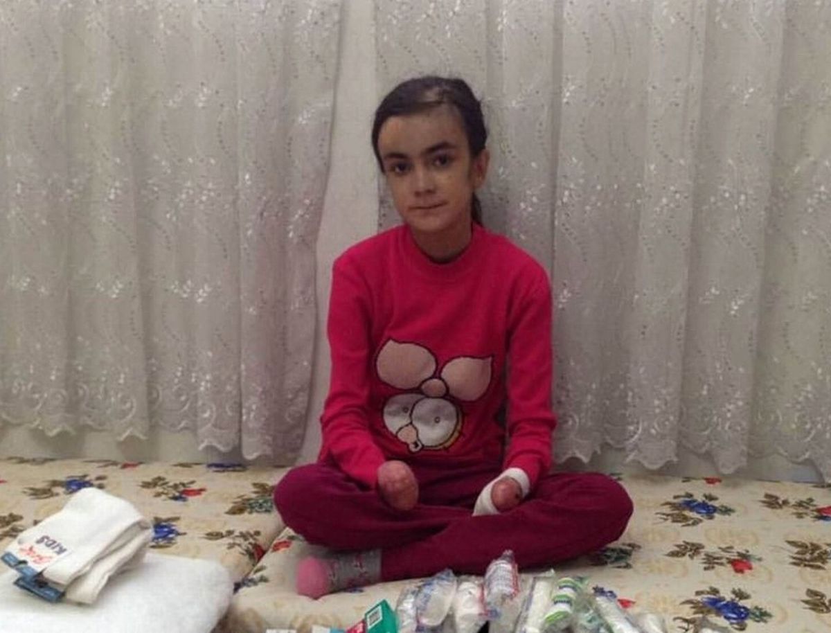 Antep\'teki Kelebek Çocuğa Diyarbakır\'dan Yardım