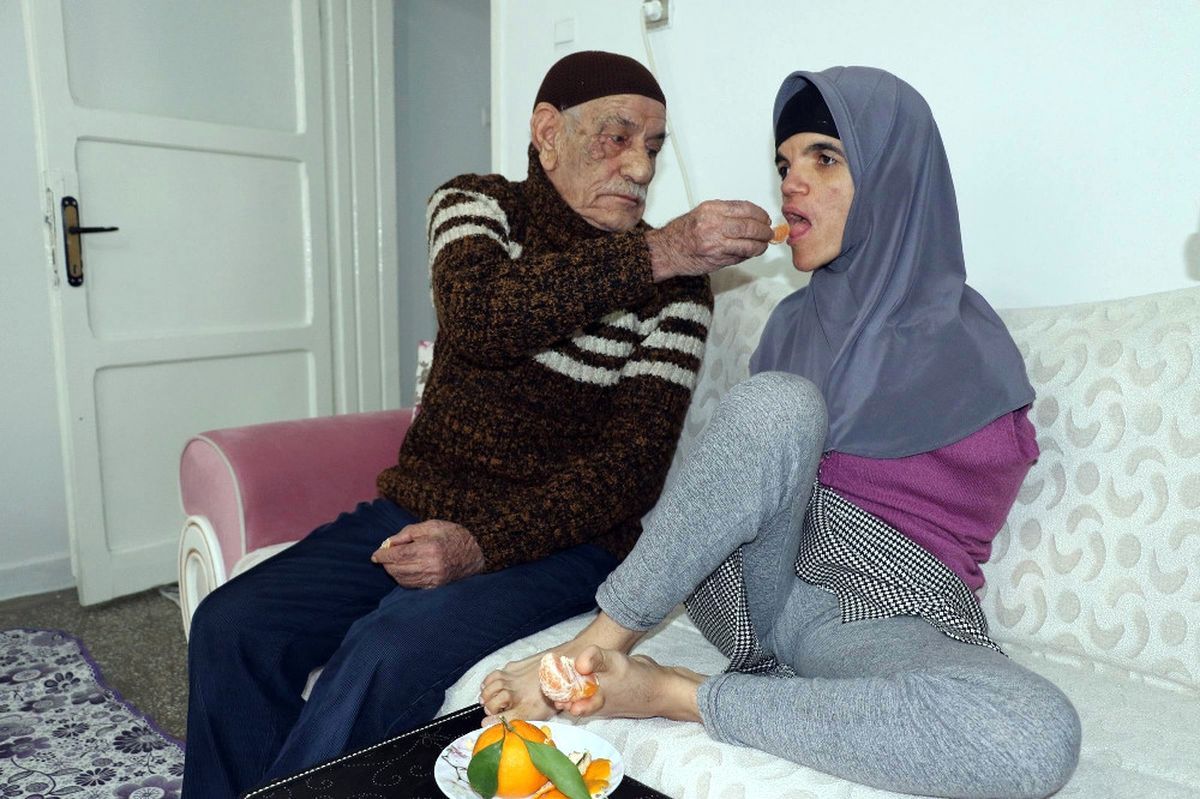 Kolsuz Hayatını Ayakları ile Aydınlattı