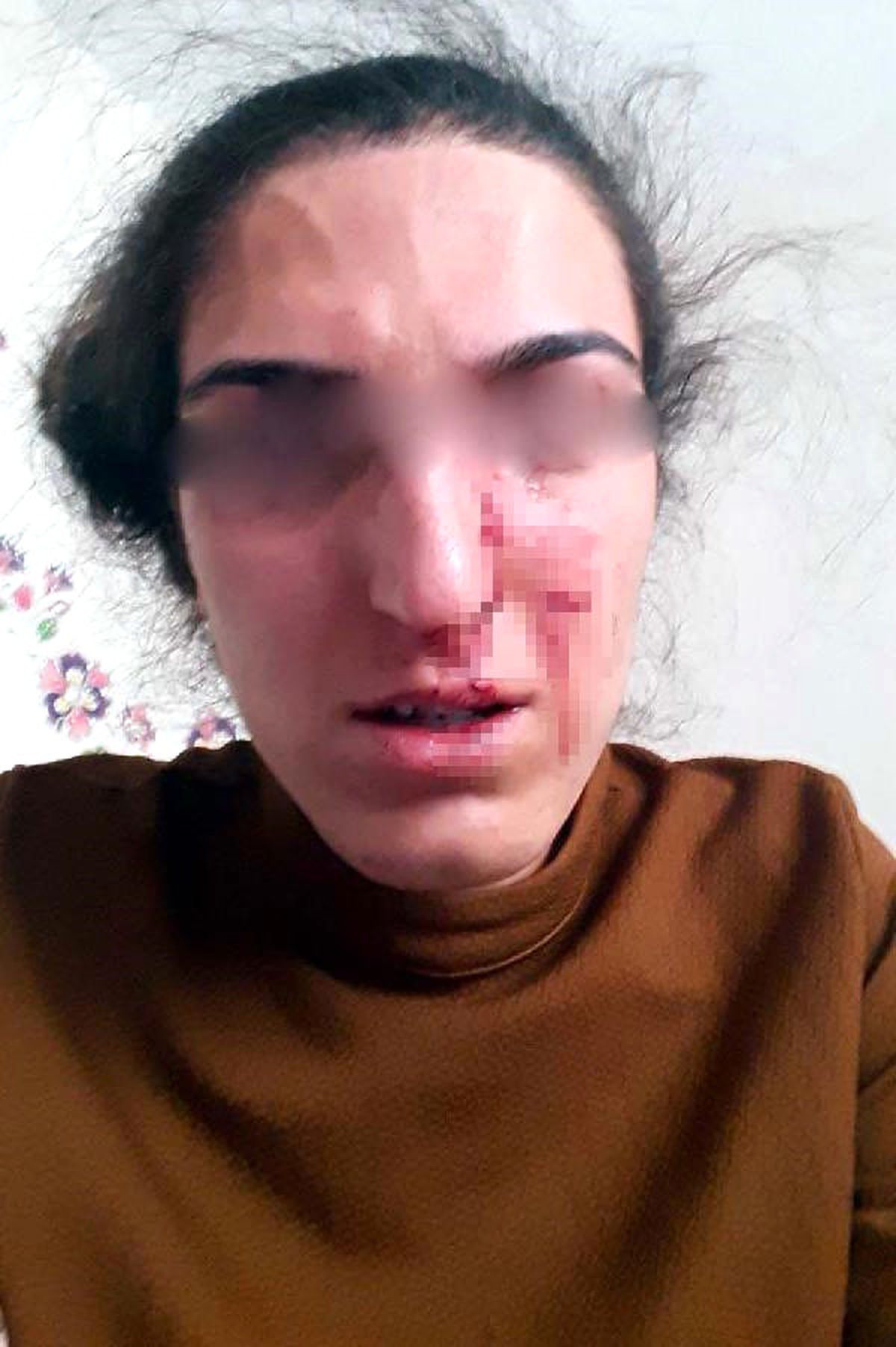 Eşinden Şiddet Gören Öğretmen: Öldürmesi mi Gerekiyor?