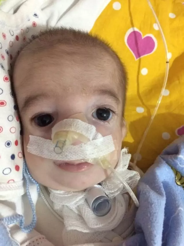 Treacher Collins Sendromlu Baran Bebek İlk Doğum Gününü