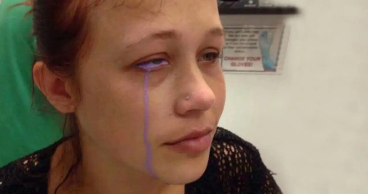 Ünlü Model Gözüne Dövme Yaptırdı, Kör Olma Tehlikesi ile Karşı Karşıya