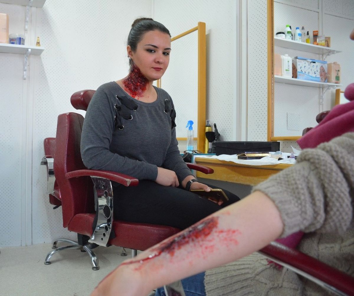 Bu Yaralar Ölümcül Değil