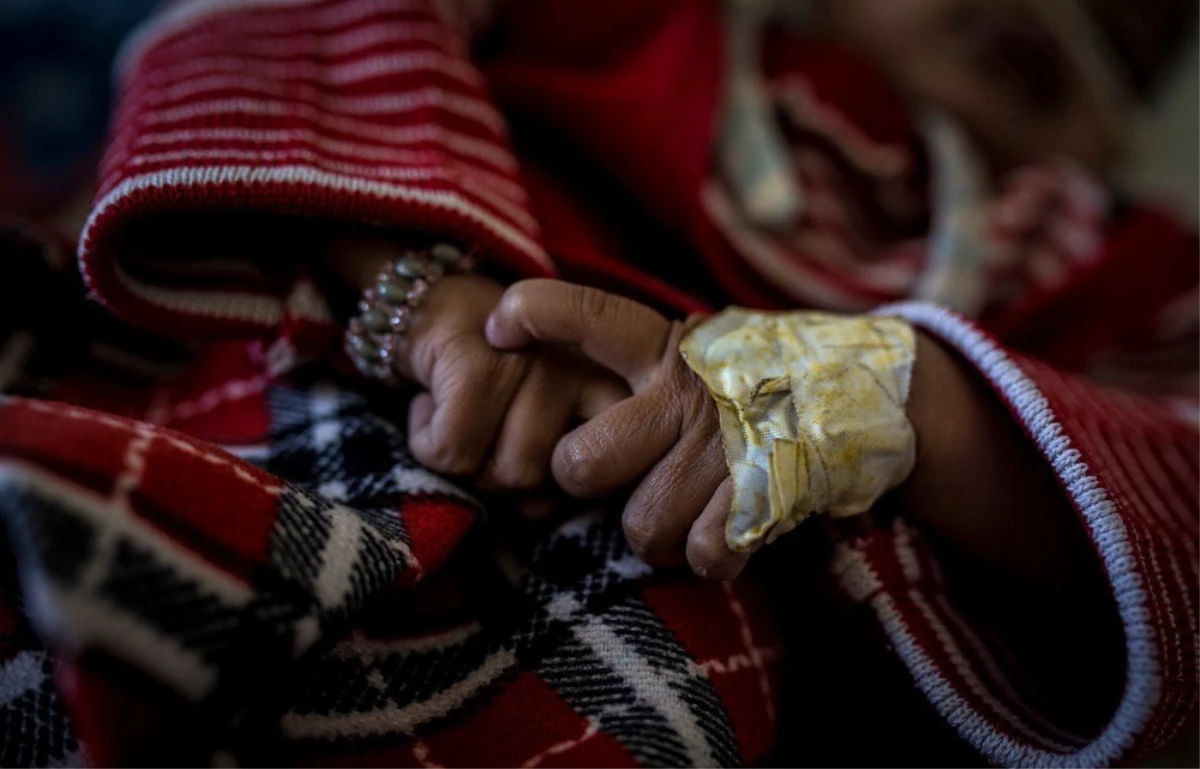 Abluka Yemen\'de Sağlık Hizmetlerine Erişimi Daha da Zorlaştırıyor
