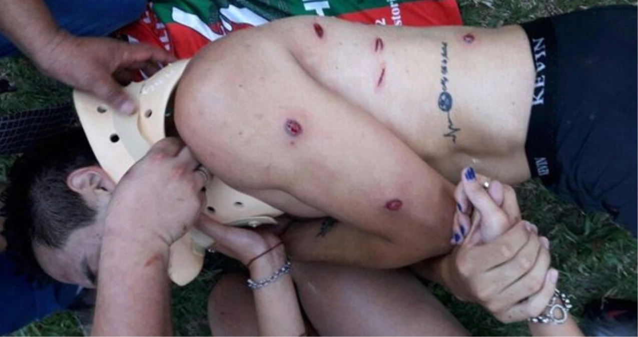 Arjantin\'de Oynanan Maçta, Polis Plastik Mermilerle Futbolcuları Vurdu