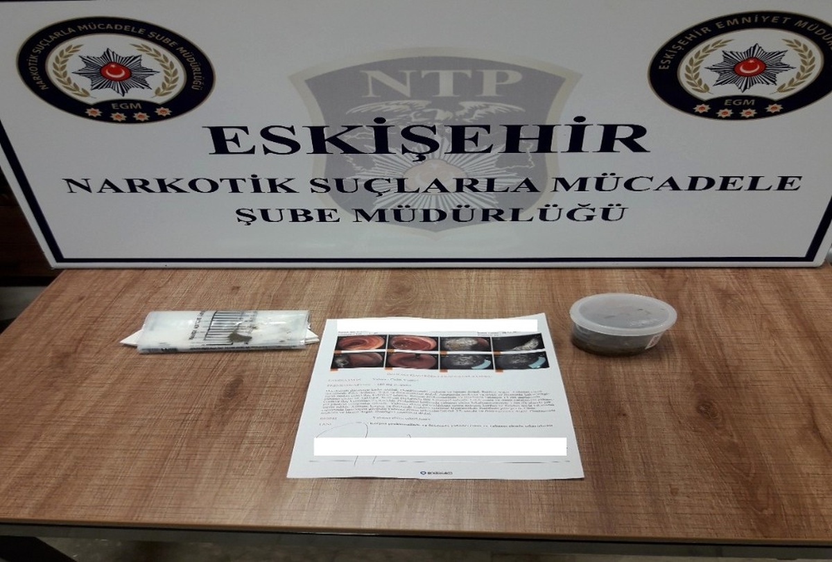 Yakalanmamak İçin Yuttuğu Uyuşturucu Endoskopi ile Çıkartıldı