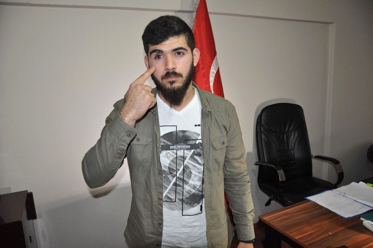 Ay Yıldızlı Kolye ile Gözünü Çıkardılar