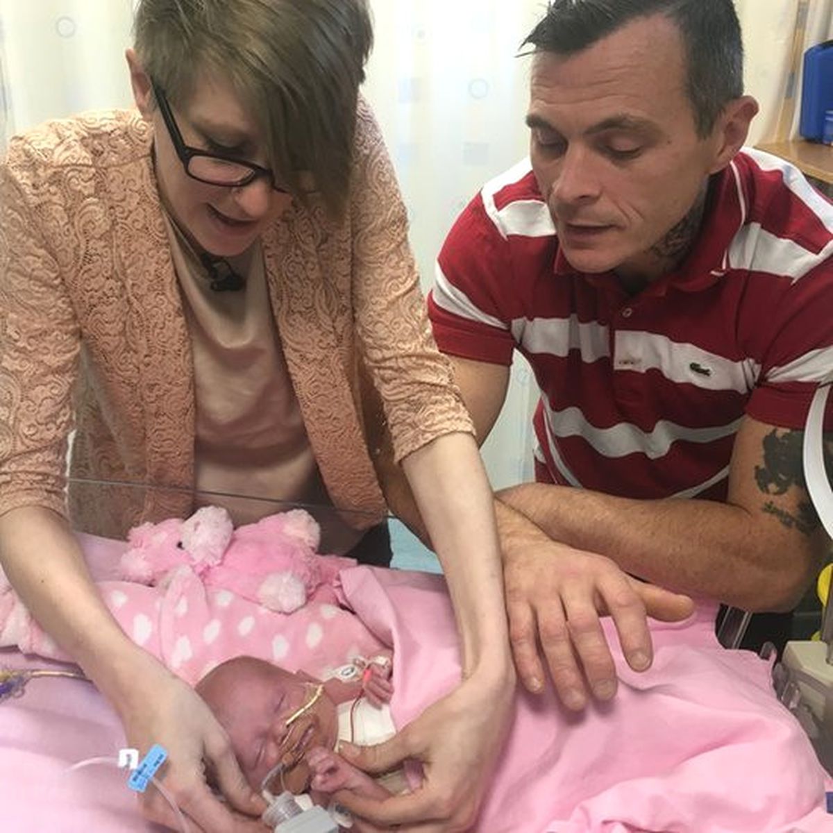 Kalbi Dışarıda Doğan Bebek Üç Ameliyatla Kurtarıldı