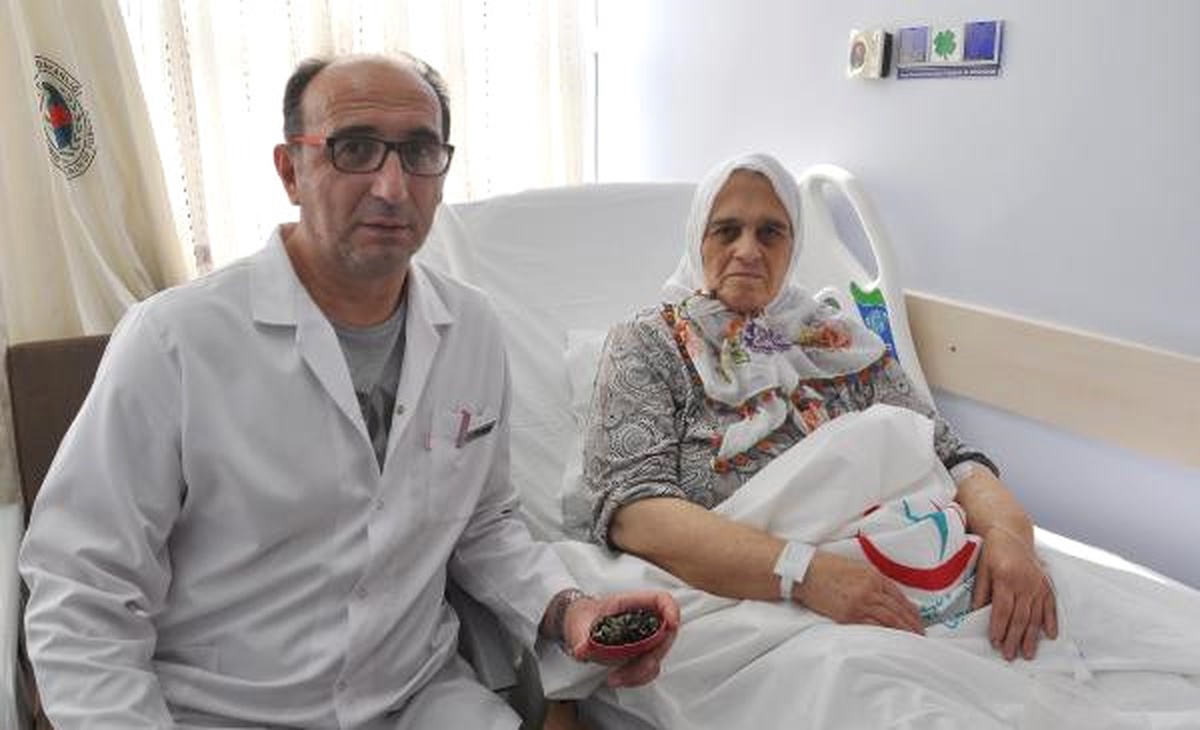 Safra Kesesinden Çıkan 34 Taşla Kolye Yapacak