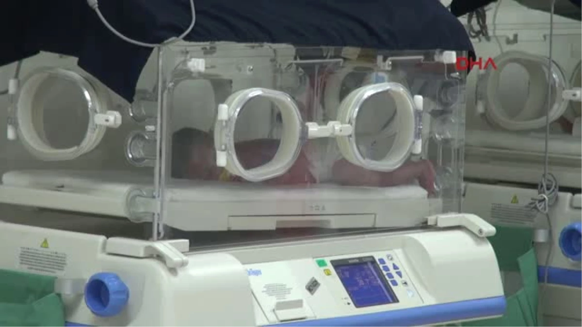 Şanlıurfa 5 Günlük Bebeğin Bağırsaklarından 1 Kilo 300 Gram Kitle Çıkarıldı
