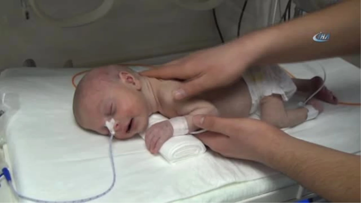 Yeni Doğan Bebeğin Karnından 1 Kilo 300 Gram Kitle Çıkarıldı