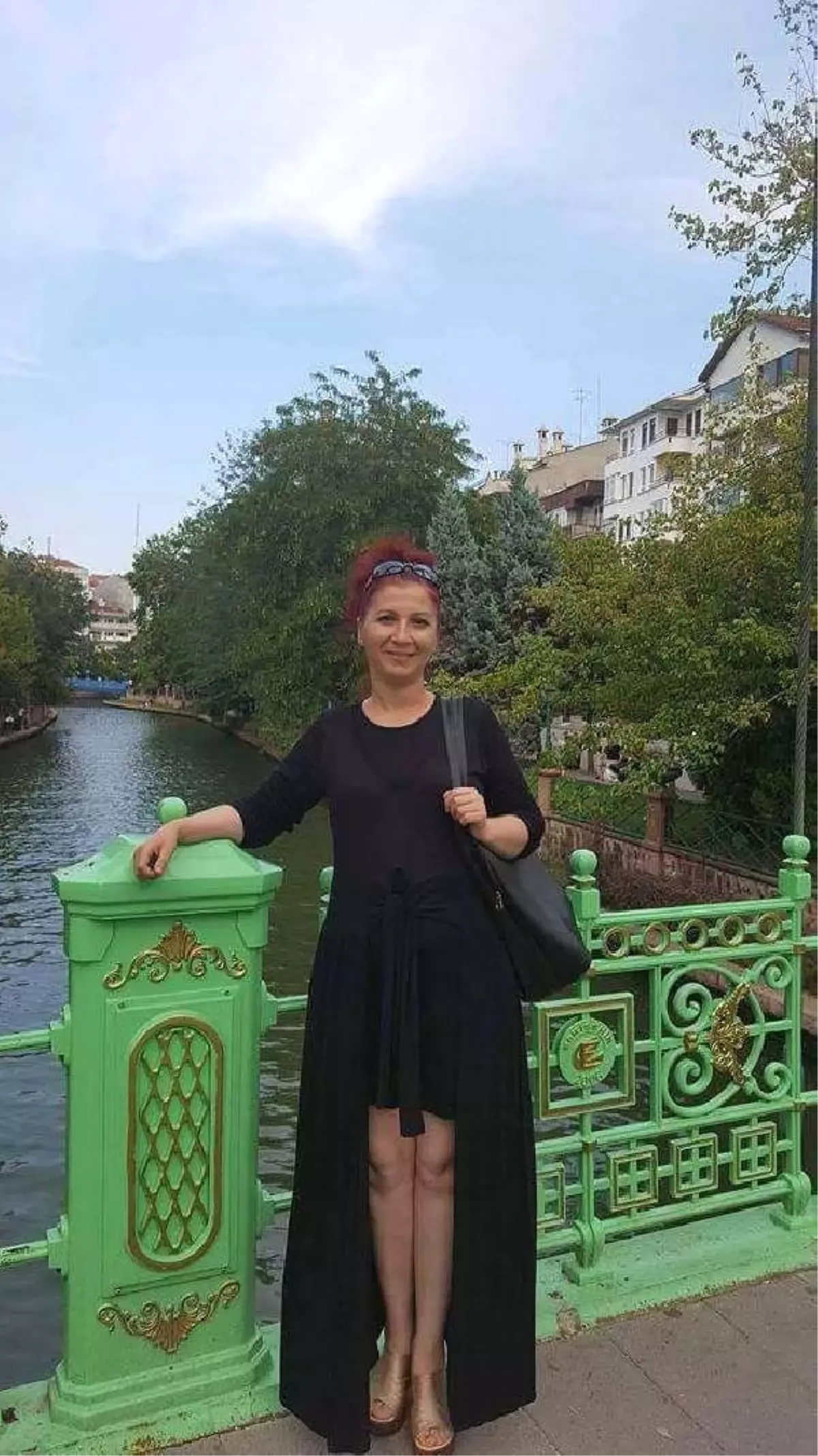 Yüzüne Kimyasal Madde Atılan Kadın: 10 Gün Önce Koruma Talebinde Bulundum, Reddedildi