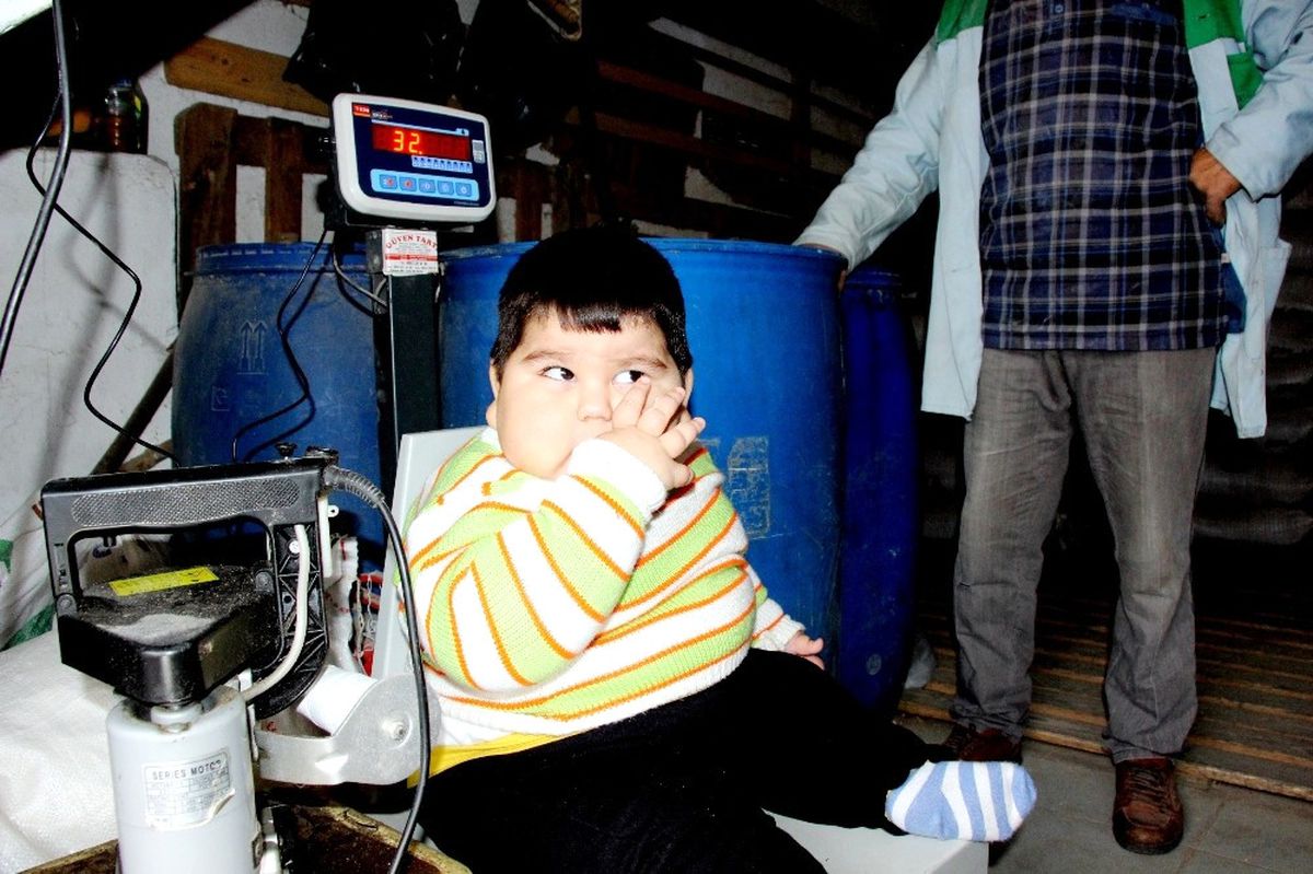 Yağız Bebek 41 Günde 5 Kilo Verdi