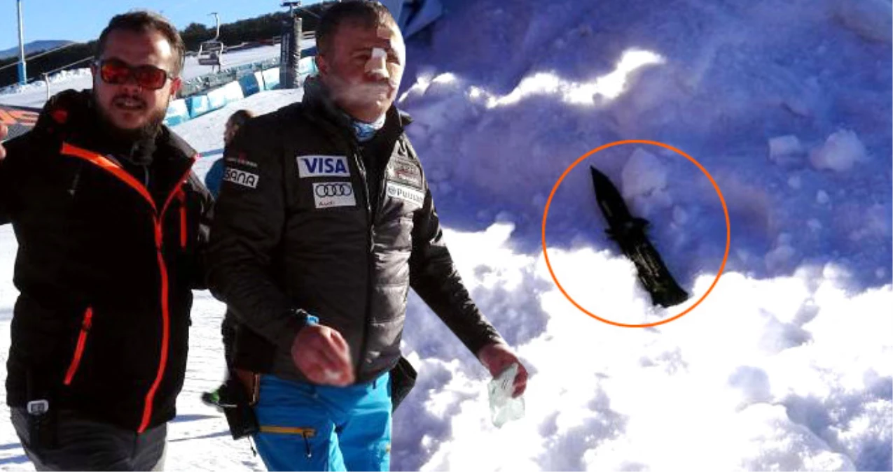 Kayak Merkezinde Saldırıya Uğrayan Milli Sporcu: Yarışlardan Çekilmem İçin Yaptılar