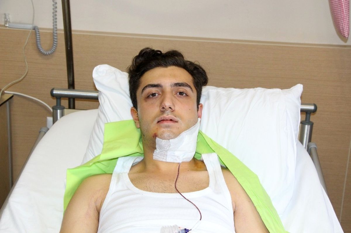 Trafik Tartışmasında Tek Yumrukla Çenesini Kıran Şahsın Yakalanmasını İstiyor