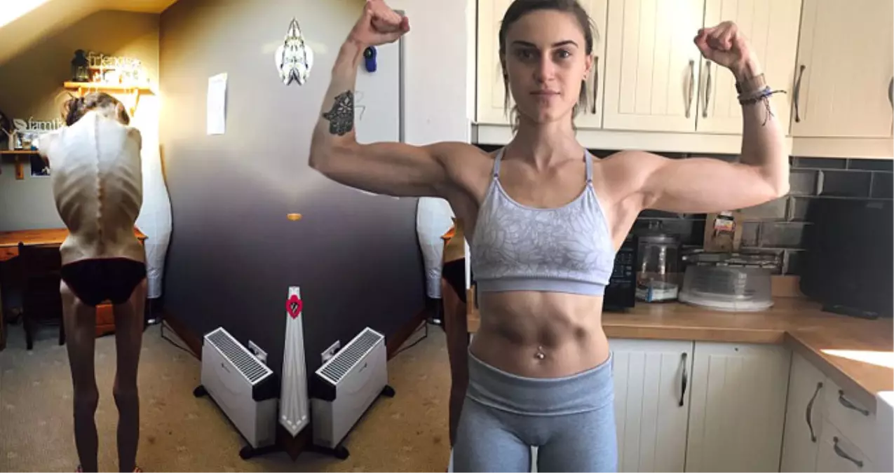 32 Kiloya Kadar Düşen Anoreksik Kadın, Instagram Sayesinde Sağlığına Geri Kavuştu