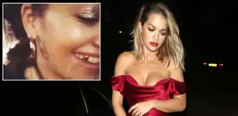 Şarkıcı Rita Ora, Taktırdığı Altın Dişleri Takipçilerine Gösterdi