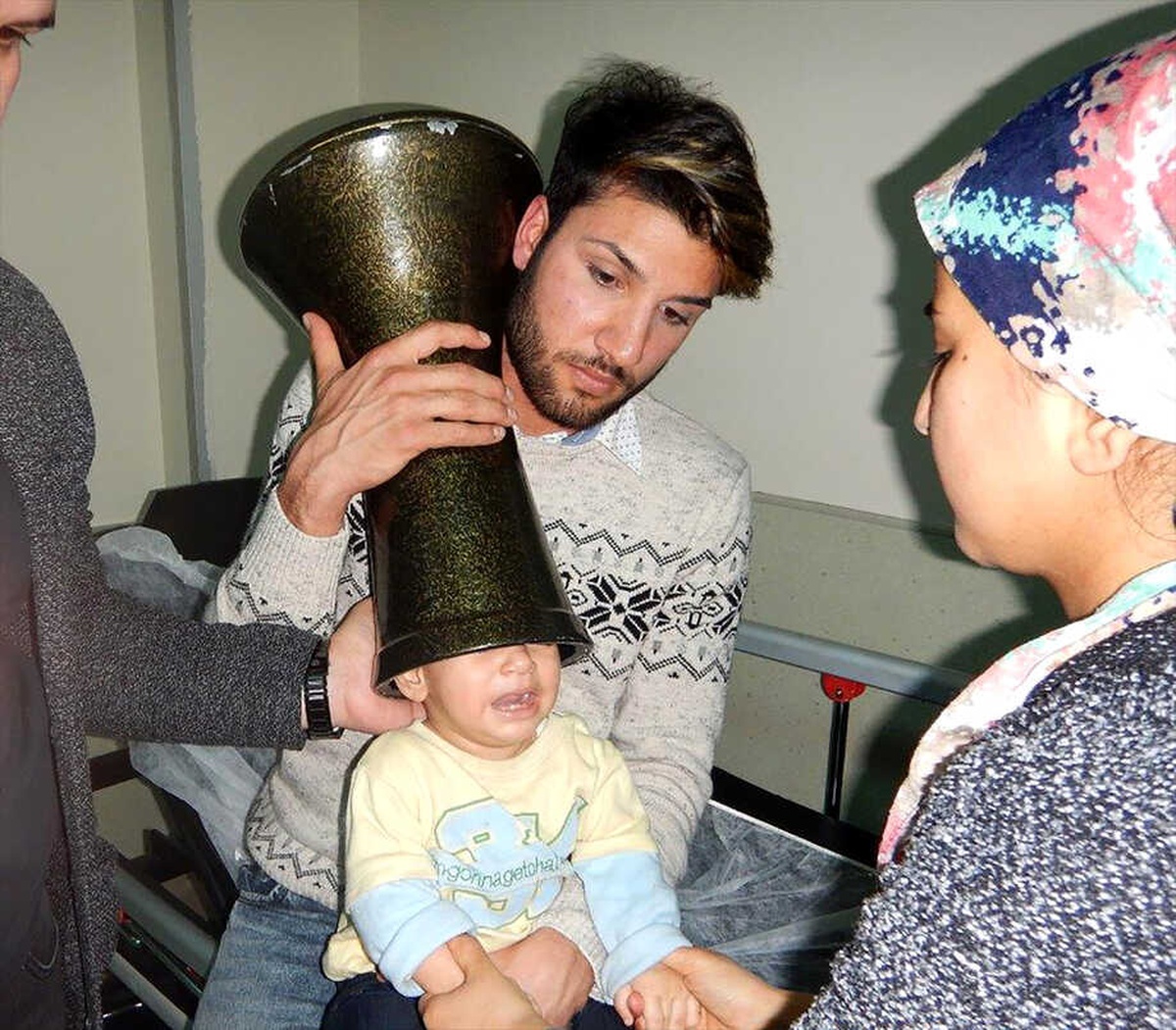 1 Yaşındaki Bebeğin Kafası Darbukaya Sıkıştı