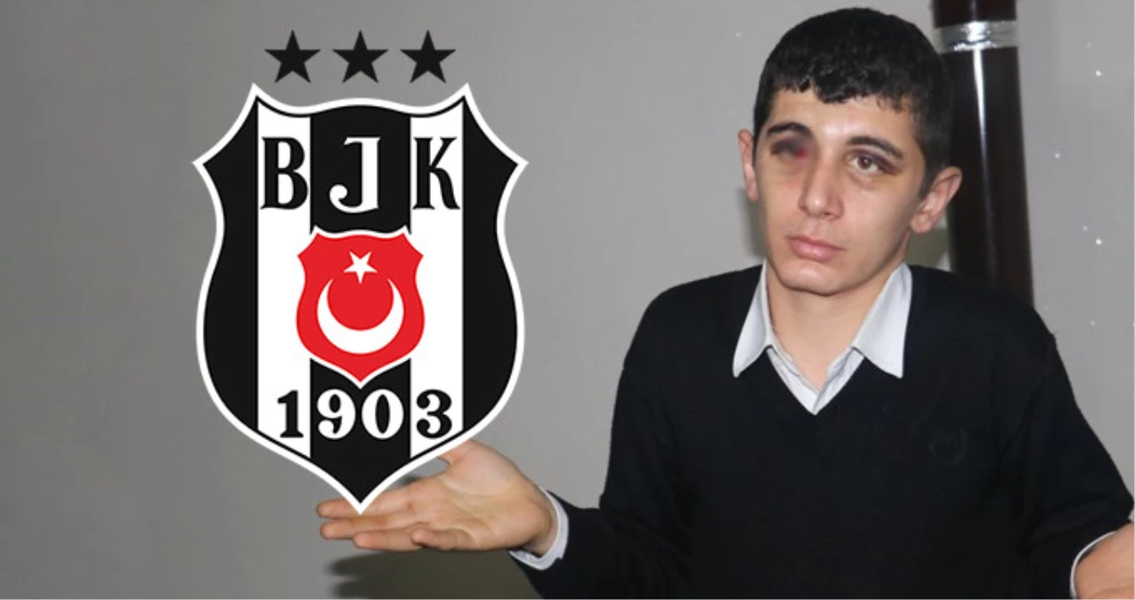 Beşiktaş, Adana\'da Saldırıya Uğrayan İşitme Engelli Genci Maça Davet Etti