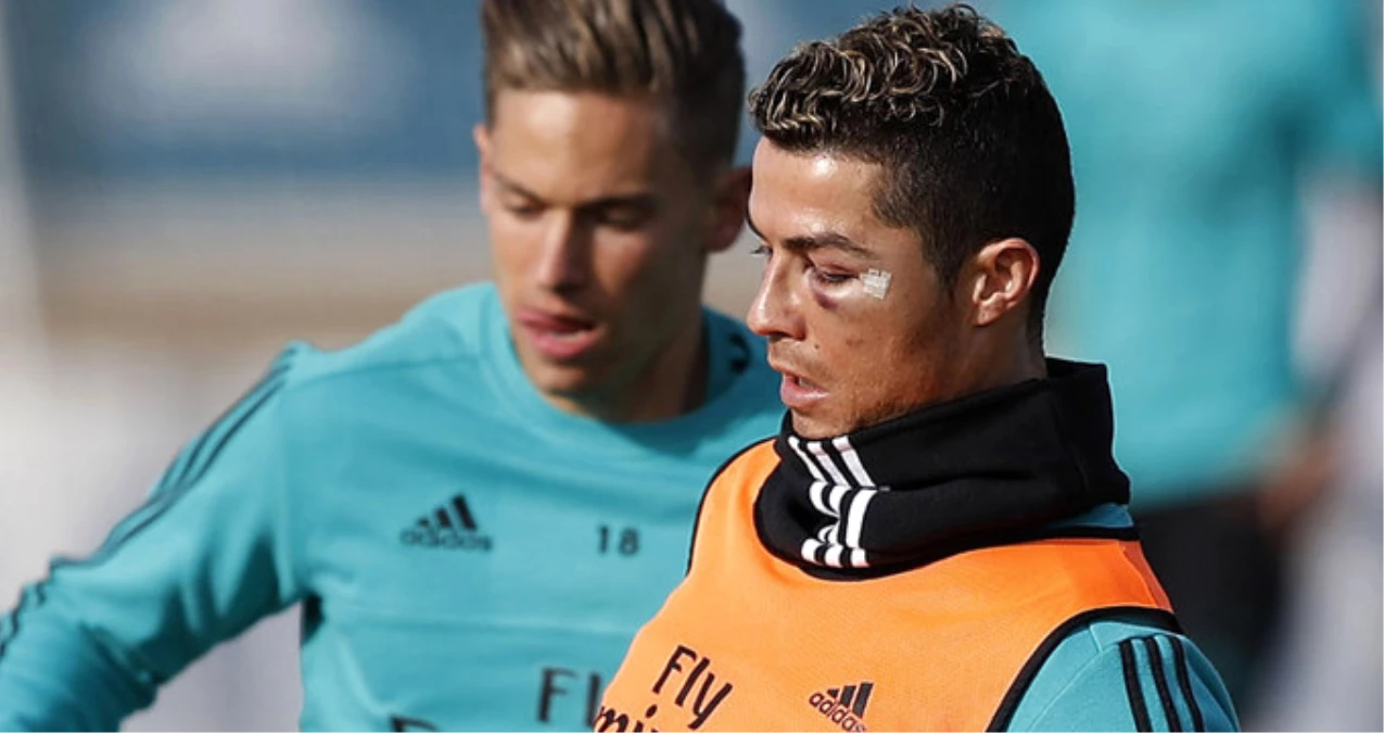 Cristiano Ronaldo\'nun Son Hali Görenleri Şaşırttı