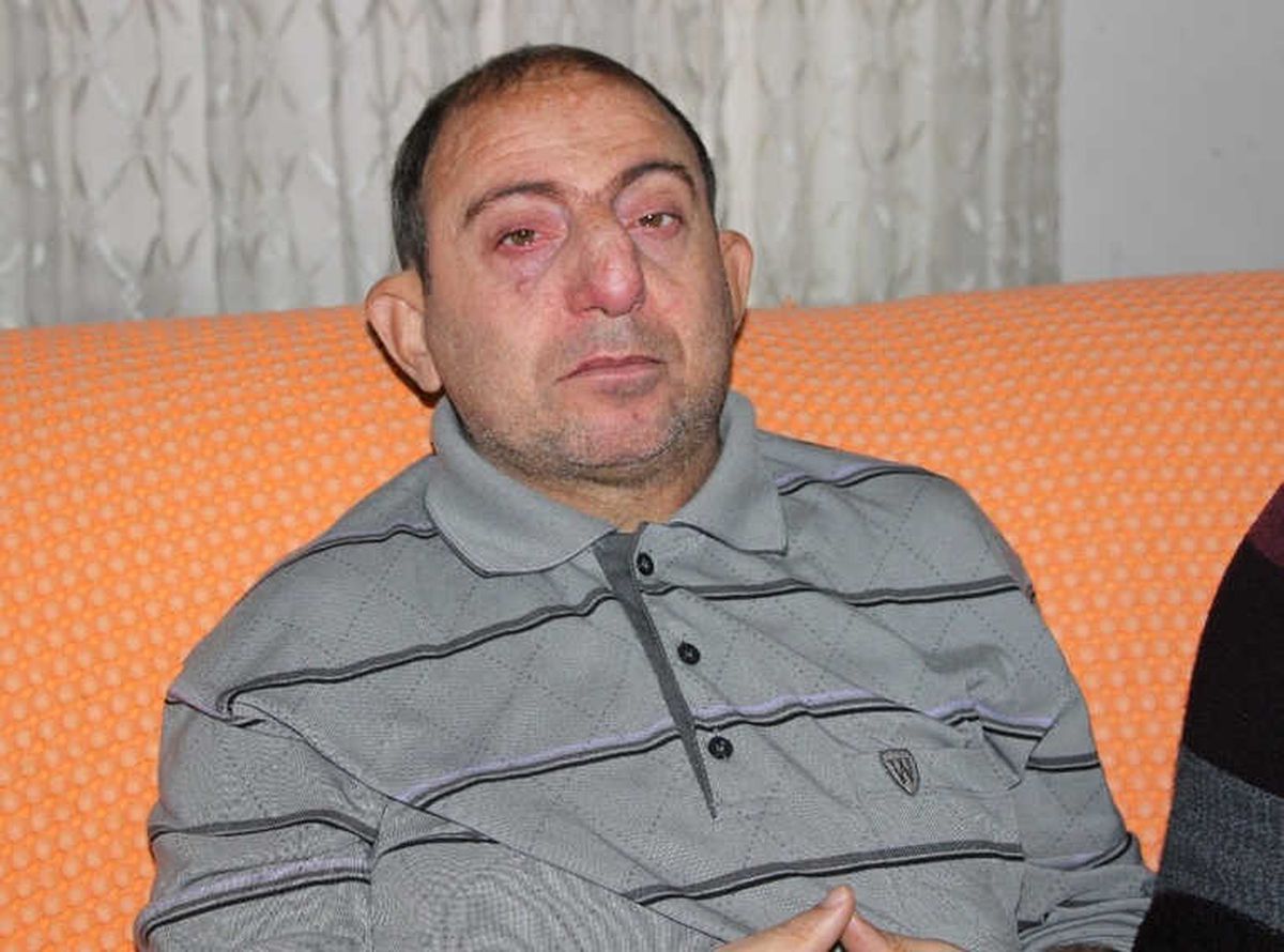 Engelli Vatandaşa Verilen 11 Bin 553 TL Para Cezası İptal Edildi