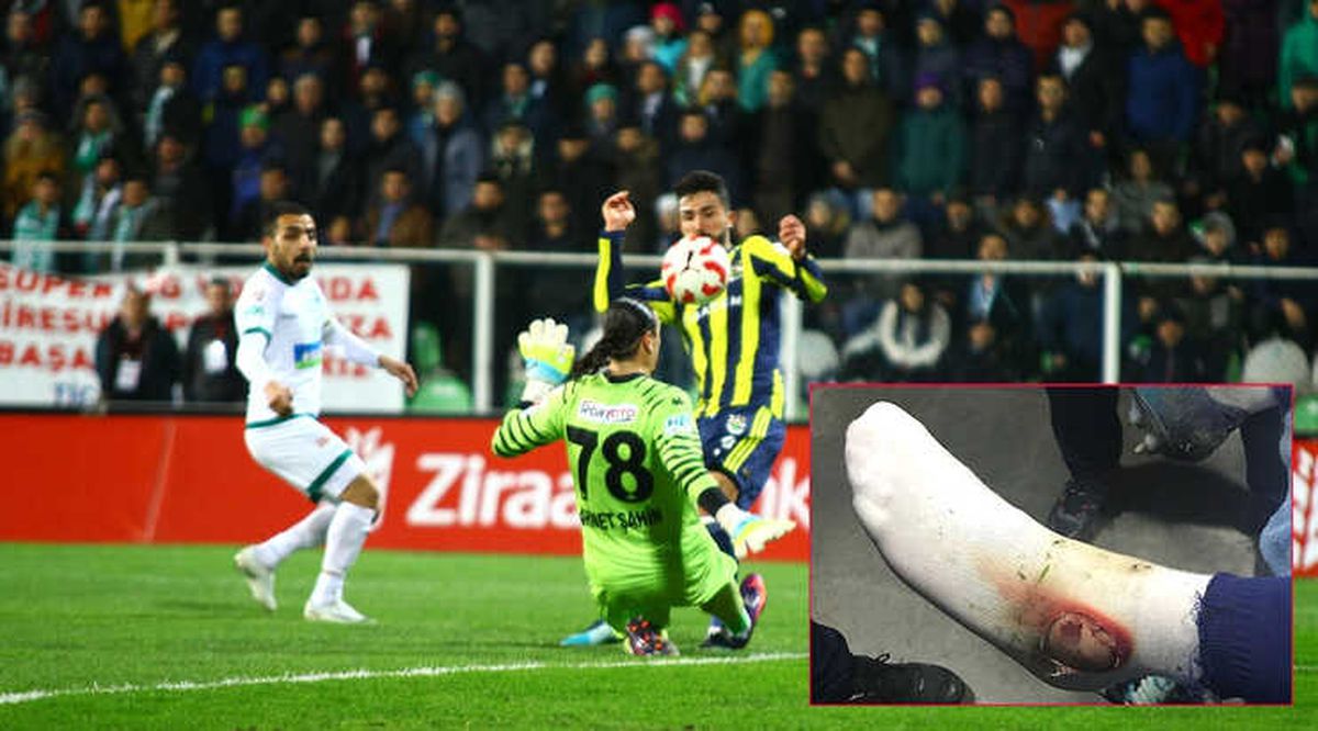 Fenerbahçe Hasan Ali Kaldırım\'ın Ayağının Fotoğrafını Paylaştı