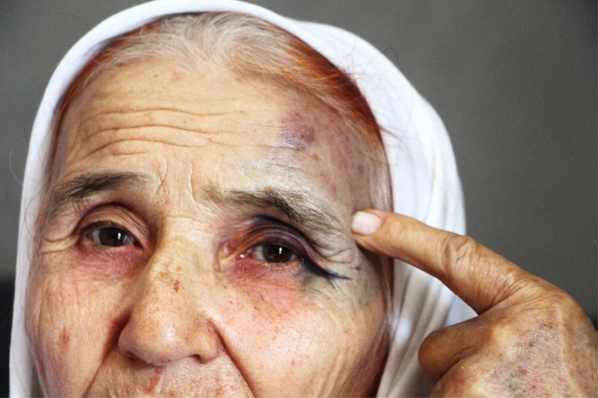 Antalya\'da 80 Yaşındaki Kadına Eski Gelininden Sokak Ortasında Dayak İddiası
