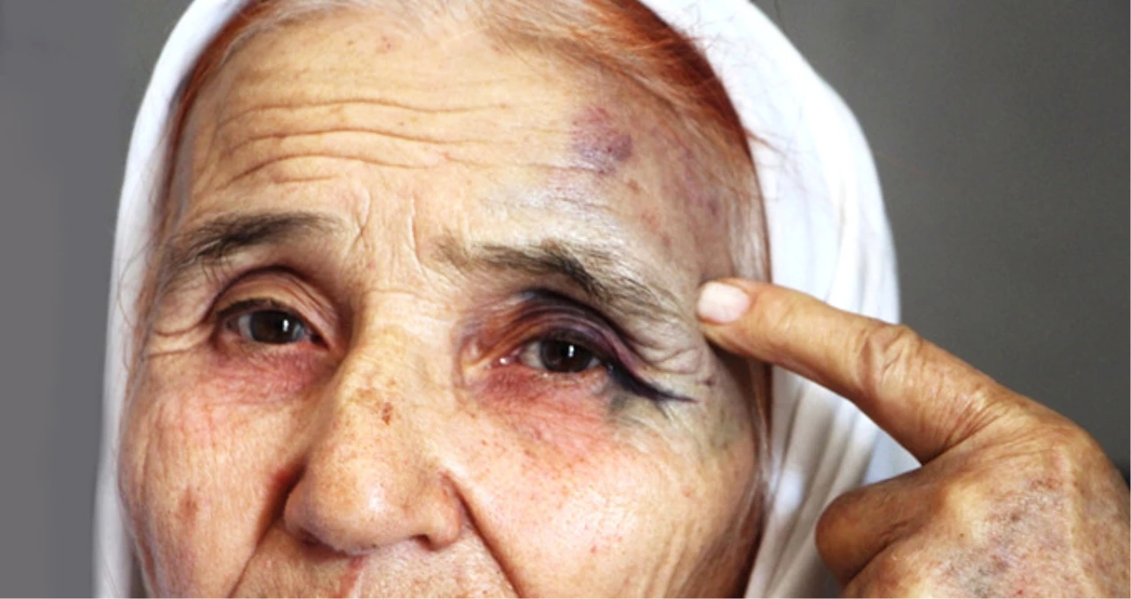 Antalya\'da 80 Yaşındaki Kadını, Eski Gelini Sokak Ortasında Dövdü