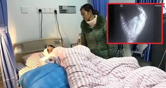 Sarjdaki Telefon Bomba Gibi Patladi Kucuk Cocuk Tek Gozu Ile Tek Elini Kaybetti Son Dakika Dunya